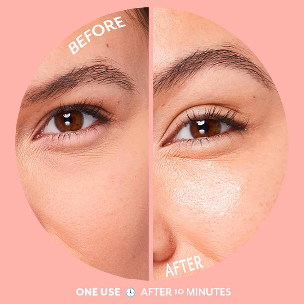 Bubbly - Serve Chilled™Brightening Eye Gels
